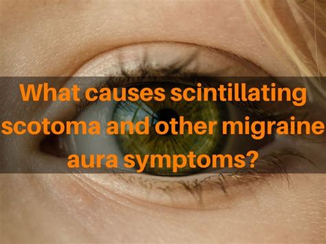 Scintillating scotoma causes with and without migraine headaches | Migraine aura, Migraine ...