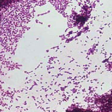 Listeria Monocytogenes Gram Stain Images - img-Aaralyn