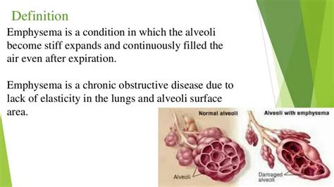 SOLUTION: Emphysema Causes | signs and symptoms | Lecture Notes - Studypool