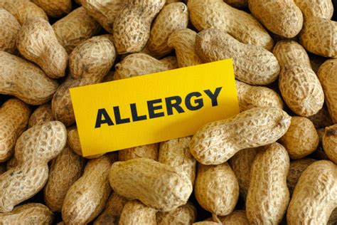 What Are Peanut Allergy Symptoms? | Food Allergies Atlanta