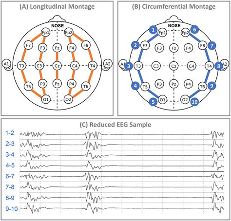 Full montage and reduced montage electroencephalogram construction.... | Download Scientific Diagram