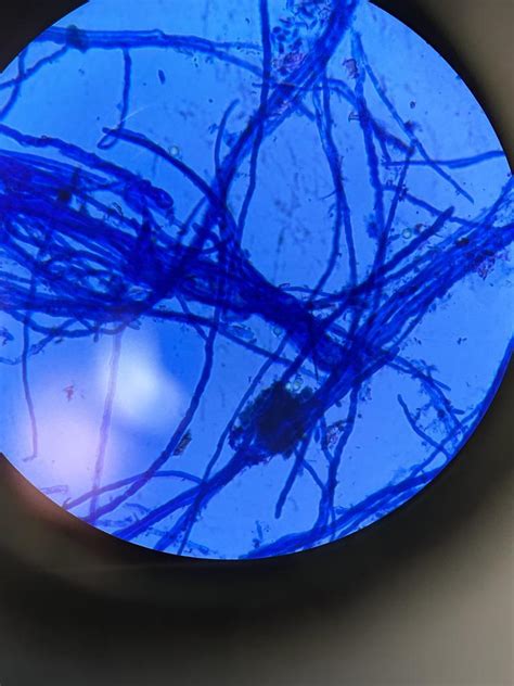 Solved 1. What is the procedure of methyl blue staining? 2. | Chegg.com ...