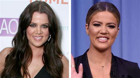 Khloe Kardashian Says She's Had Fillers Gone Wrong, Reveals She Wanted ...