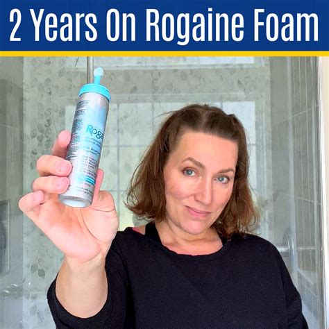 My Minoxidil Results After 2 Years: Rogaine Before And After For Women! - Abbotts At Home