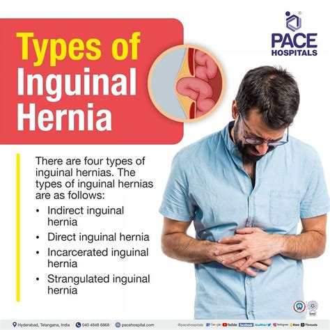 Inguinal Hernia - Signs and Symptoms, Types, Causes, Risk Factors