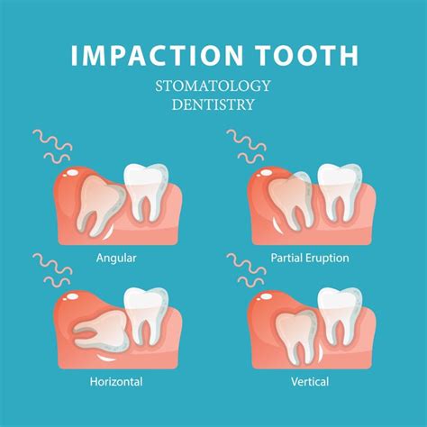 Pin on Dental Tips & Pointers