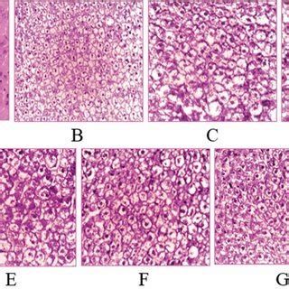 Histopathological features after PAS staining of liver sections from a... | Download Scientific ...