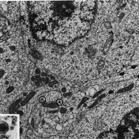 Retinoblastoma cells treated with dbc-AMP in serum-free medium ...