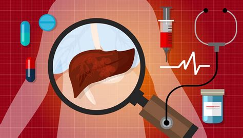 Chemoembolization For Liver Cancer - HealthStatus