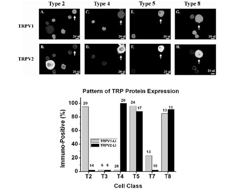 TRP Protein Expression in Subclassified Nociceptors. TRP proteins were ...