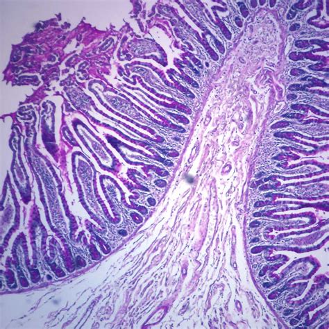 Human Goblet Cells, sec. 7 µm H&E Microscope Slide | Carolina Biological Supply