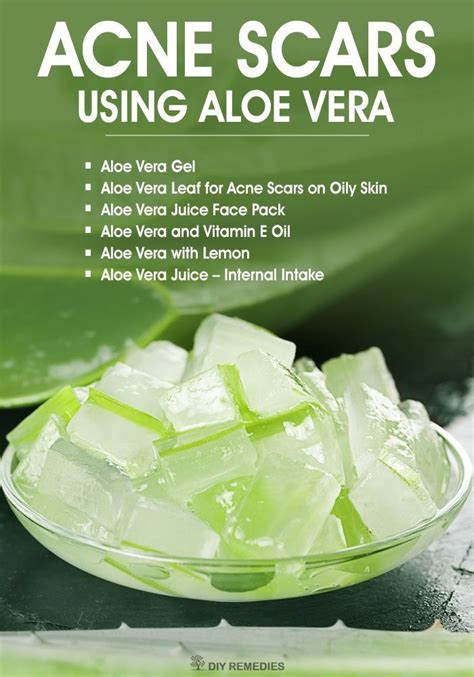 Pin on Skin Care Acne Home Remedies