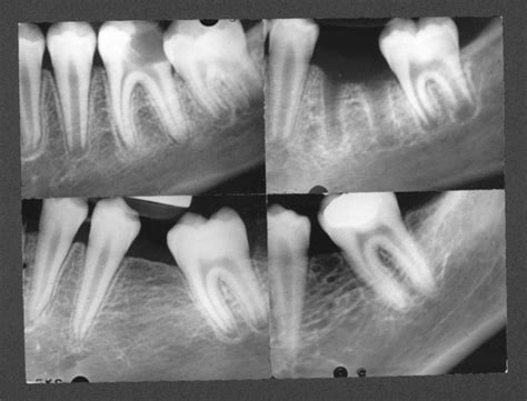 27: Managing the Developing Occlusion | Pocket Dentistry