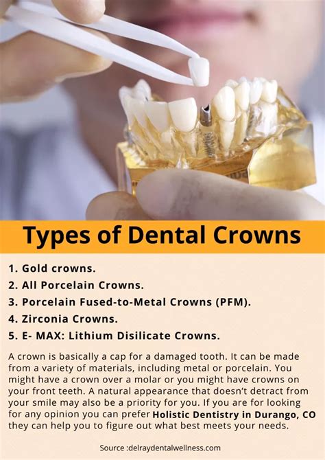 PPT - Types of Dental Crowns PowerPoint Presentation, free download ...