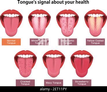 Healthy Tongue Color