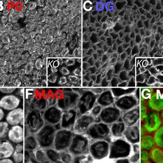 Localization of CD59 in human sural nerve. A–C Immunohistochemical ...