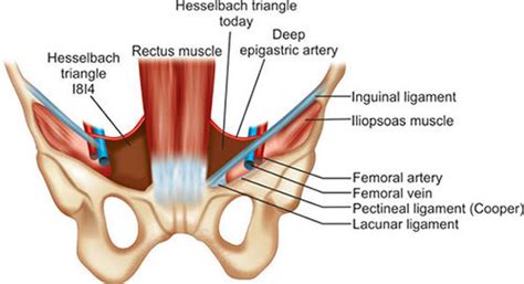 Lacunar Ligament Cadaver