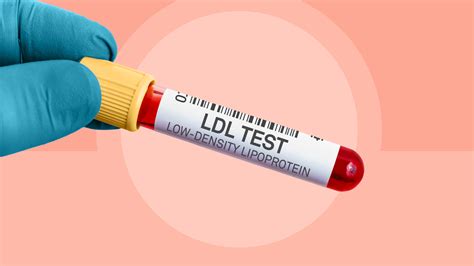 What Is LDL Cholesterol?, 51% OFF | www.gbu-presnenskij.ru
