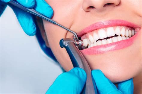 Dental cleaning (scaling and polishing) – patna dental hospita