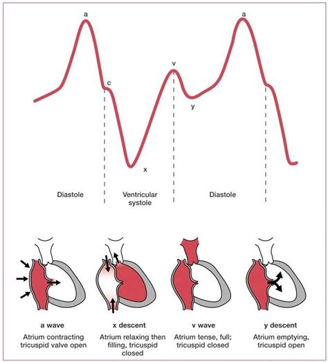 Pin by Caroline Grace * on EKGs! | Central venous pressure, Cardiac ...