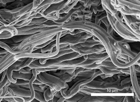 Isolated elastin fibers of a 6-year-old individual.