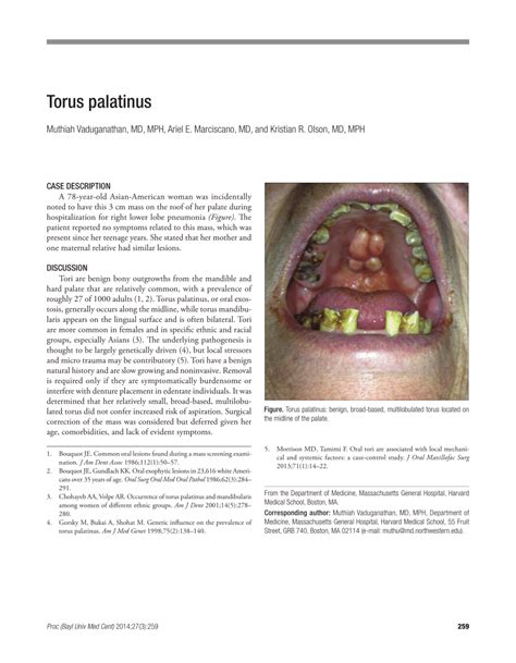 (PDF) Torus Palatinus