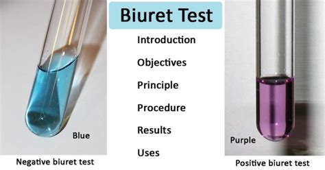 Biuret Test for Protein- Definition, Principle, Procedure, Results, Uses