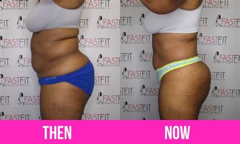 How Much Does Fast Fit Body Sculpting Cost? - Fast Fit Body Sculpting