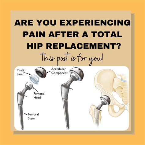 Pain After Total Hip Replacement - Orthowell Physical Therapy