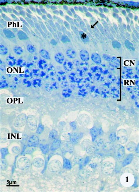 Giant mitochondria in the retina cone inner segments of shrews of genus Sorex (Insectivora ...