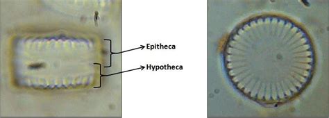 Image of (a) girdle view and (b) valve view of a centrale diatom... | Download Scientific Diagram