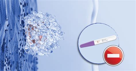 Recurrent Implantation Failure | Indore Infertility Clinic