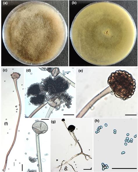 Rhizopus Spp Structure, Life Cycle, Habitat, Pathogenesis, 50% OFF