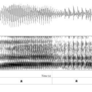 Creaky voice (FM65). | Download Scientific Diagram