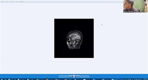 Radiology Cases » Division of Pediatric Neurology » College of Medicine » University of Florida