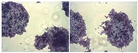 Alkaline Phosphatase Staining Kit (Purple) (ab242287) | Abcam