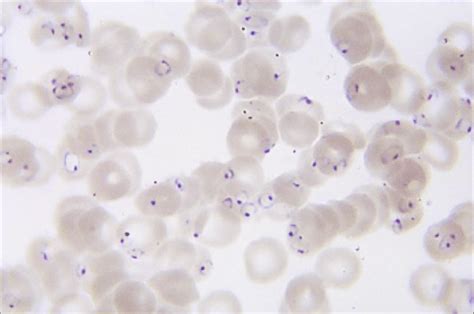 Plasmodium Falciparum Trophozoite