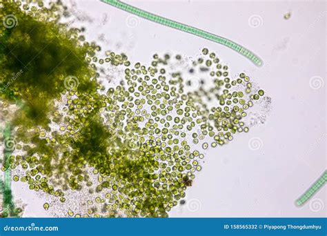 Chlorella Under the Microscope in Lab. Stock Photo - Image of bloom, culture: 158565332