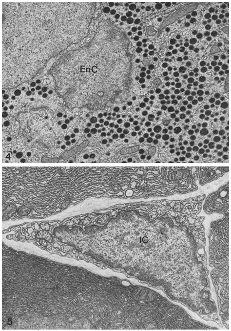 Interstitial cells (IC) are found within the intercellular spaces and ...