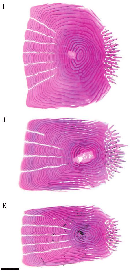 Ctenoid scales of Myxus elongatus (DMM IE/16697, SL = 3.8 cm) from the... | Download Scientific ...