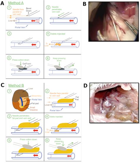 Murine Model of Islet Transplantation: A Surgical Method to Infuse Pancreatic Islets in Portal ...