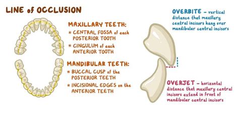 ANGLE'S CLASSIFICATION OF MALOCCLUSION DENTODONTICS, 51% OFF