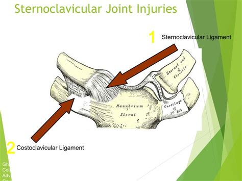 PPT - Orthopedics Injury PowerPoint Presentation - ID:6134100