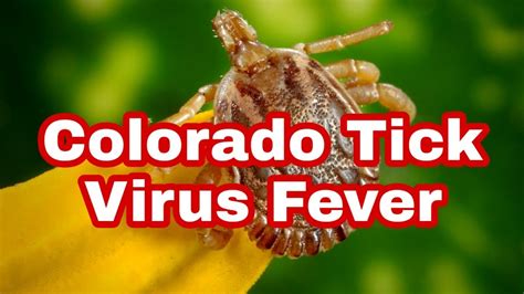 Colorado Tick Fever Symptoms And Treatment | Hot Sex Picture