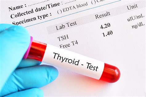 Thyroid Function Tests & Hypothyroidism