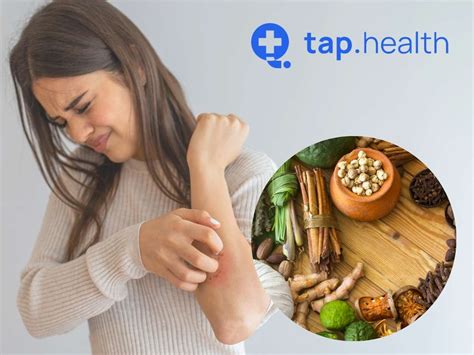 Ayurvedic Treatment For Eczema: 8 Effective Remedies - Tap Health