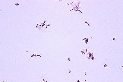 Abiotrophia defectiva - microbewiki