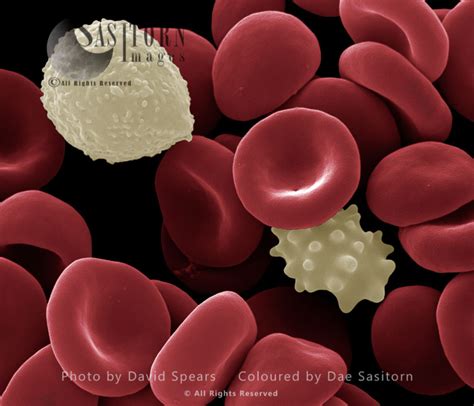 SEM: Human White and Red Blood Cells; Magnification x 12,000 at A4 print size - Sasy Images