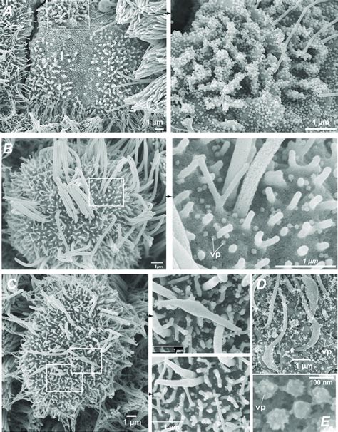 SARS-CoV-2 infection causes an early loss of motile cilia. A Scanning ...