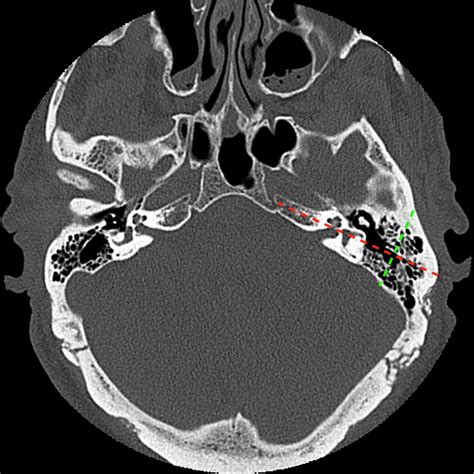 Image | Radiopaedia.org